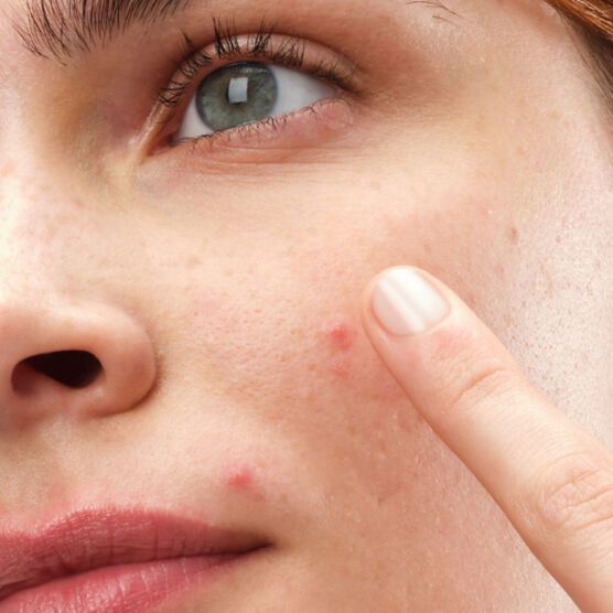 SULFUR 10% POWDER-TO-CREAM CONCENTRATE